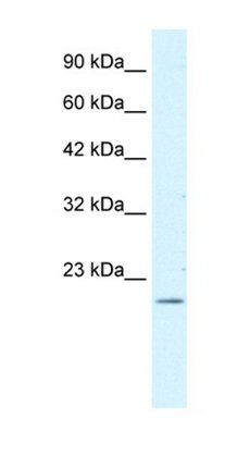 FOXP2 antibody