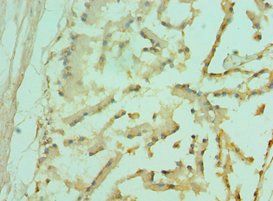 FOXP2 Antibody