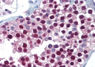 Goat anti-FOXP2 (C terminus) Antibody