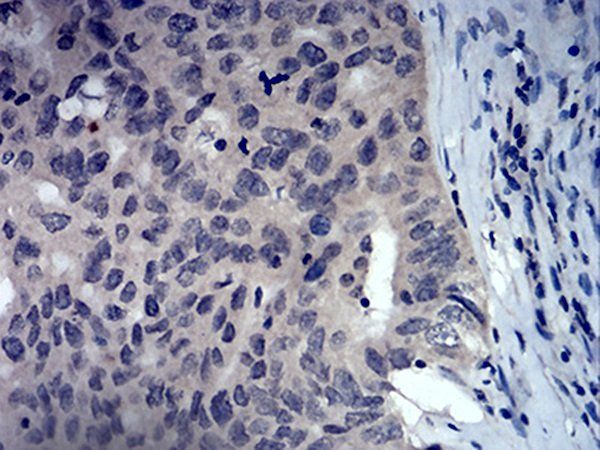 FOXP3 Antibody