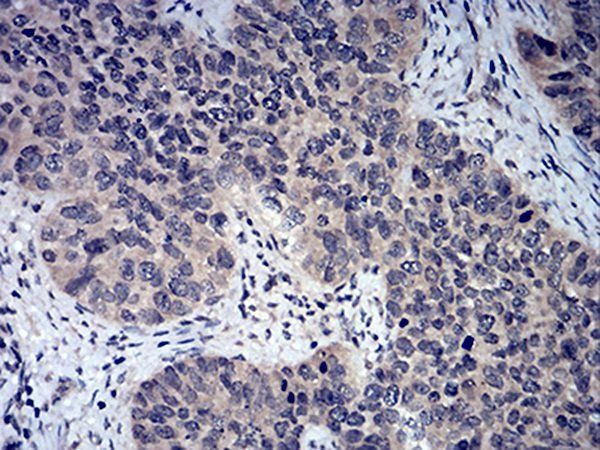 FOXP3 Antibody