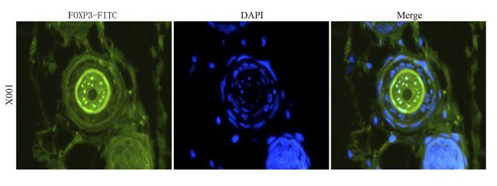 FOXP3 antibody (FITC)