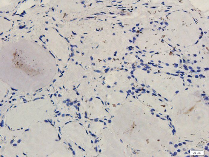 FOXP3 antibody