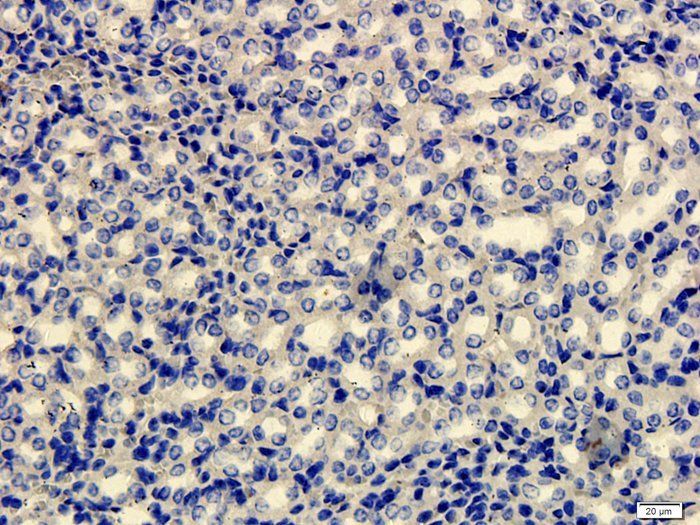 FOXP3 antibody