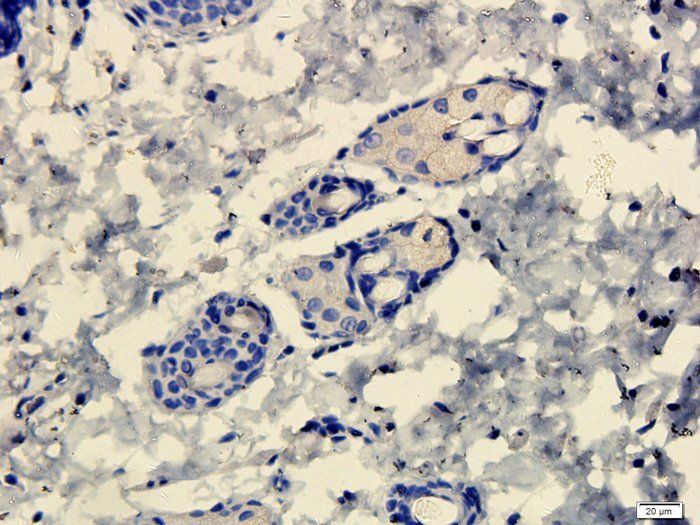 FOXP3 antibody