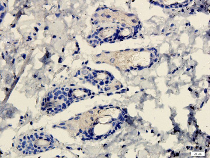 FOXP3 antibody