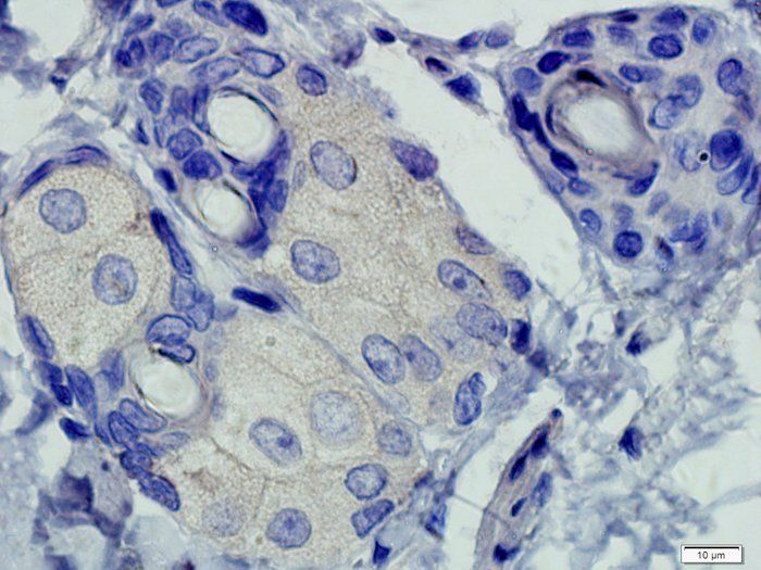 FOXP3 antibody