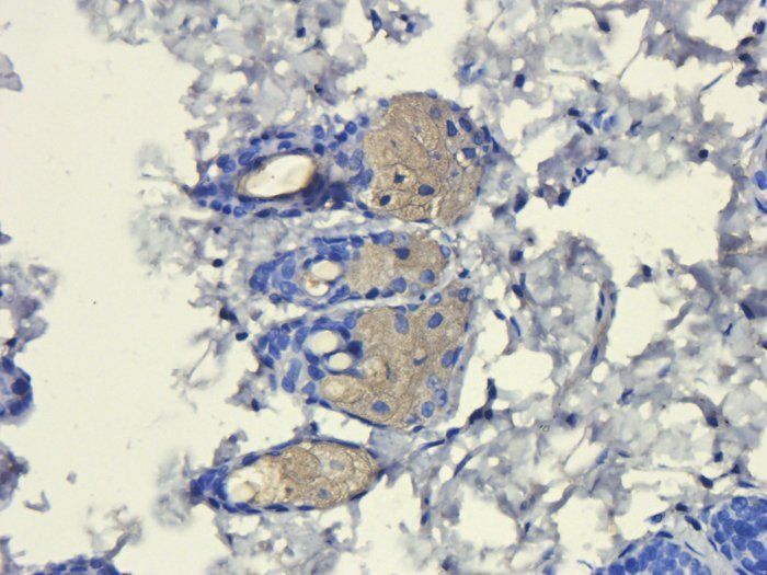 FOXP3 antibody