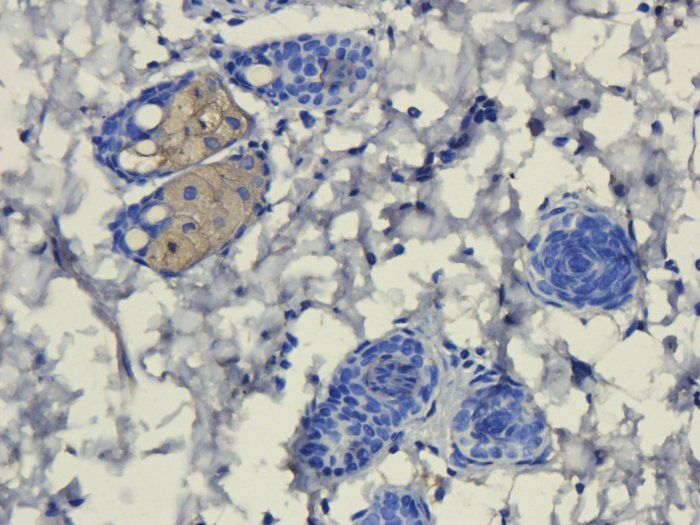 FOXP3 antibody