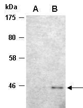 Foxp3 (N) Antibody, Rabbit Polyclonal