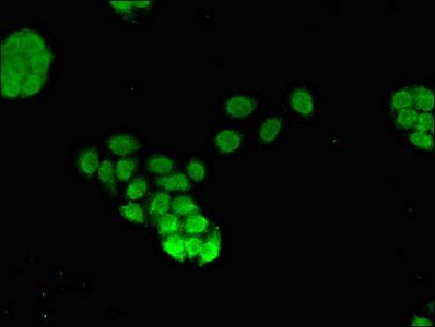 FOXQ1 antibody