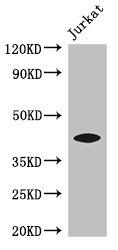 FOXQ1 antibody