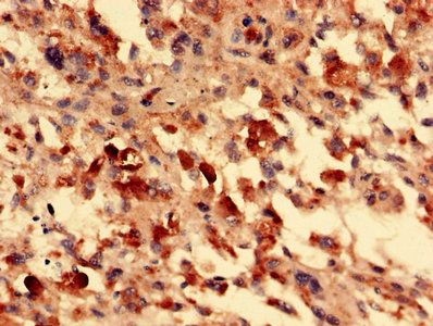 FOXR2 Antibody