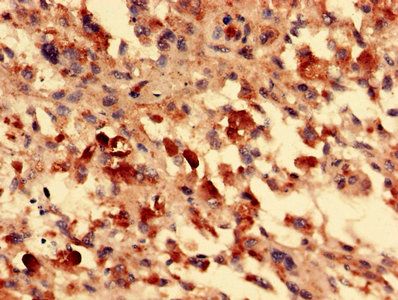 FOXR2 antibody