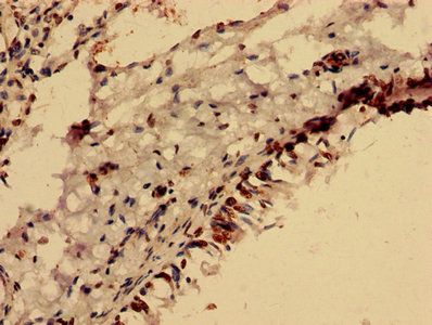 FOXR2 Antibody