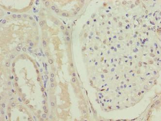 FOXR2 Antibody
