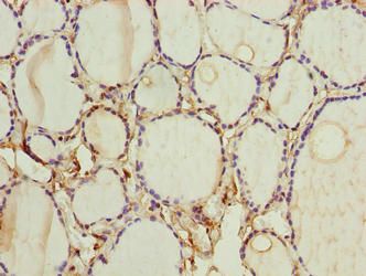 FOXR2 Antibody