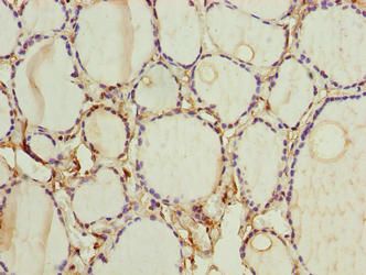 FOXR2 antibody