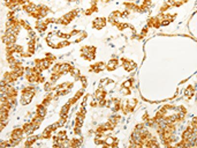 FOXR2 antibody