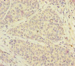 FOXRED1 Antibody