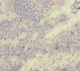 FOXRED1 Antibody