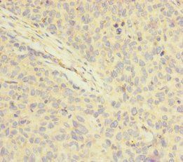 FOXRED1 Antibody