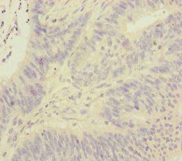 FOXRED1 Antibody