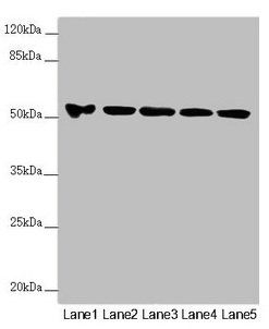 FOXRED1 antibody