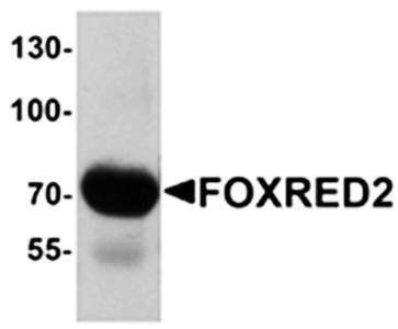 FOXRED2 Antibody