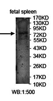 FOXRED2 Rabbit Polyclonal Antibody