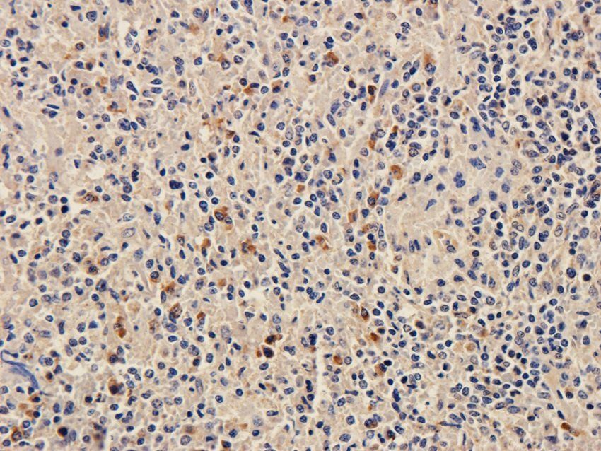 FPR1 antibody