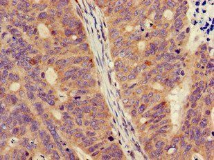 FPR3 Antibody