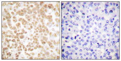 Fra-2 Antibody