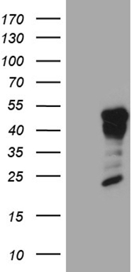 FOSL2 Antibody