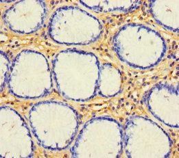 CX3CL1 Antibody