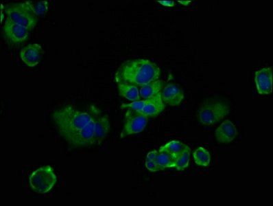 FREM2 antibody