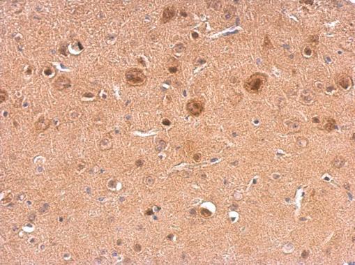 NCS1 antibody