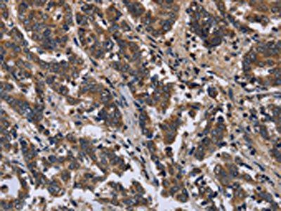 FRK Antibody