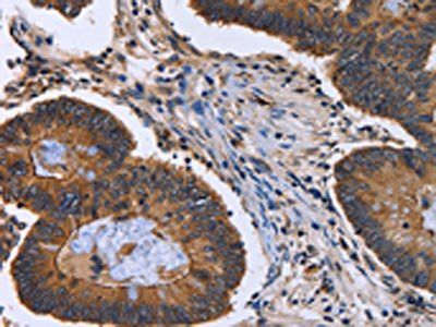 FRK Antibody