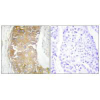 FRK Antibody