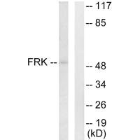 FRK antibody