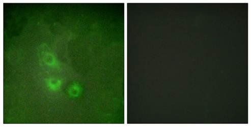 FRK Antibody