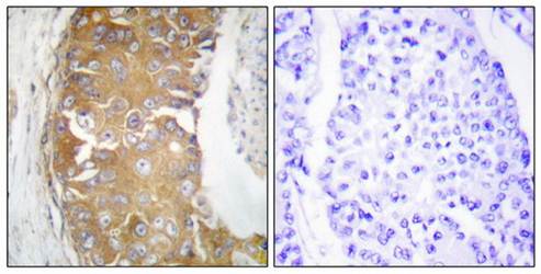 FRK Antibody