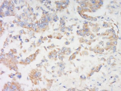 FRMD1 Rabbit Polyclonal Antibody