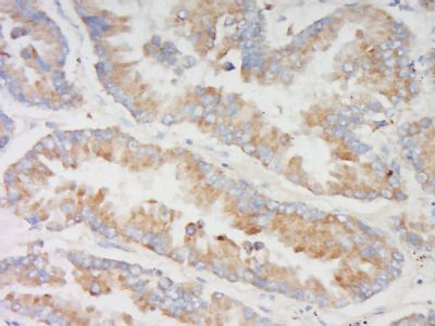 FRMD1 Rabbit Polyclonal Antibody