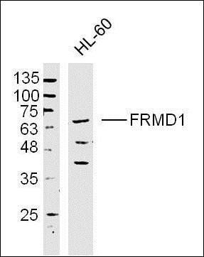 FRMD1 Rabbit Polyclonal Antibody