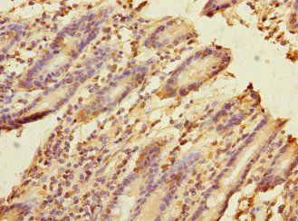 FRMD6 Antibody