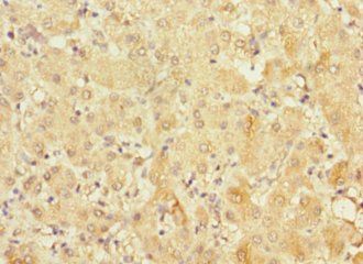 FRMD6 Antibody