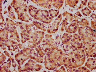 FRMD7 Antibody