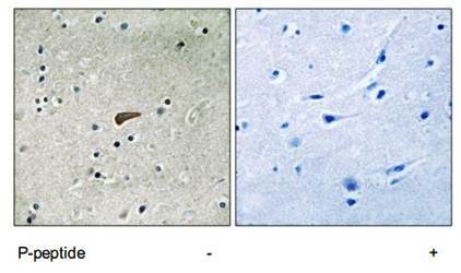 FRS2 (Phospho-Tyr436) Antibody